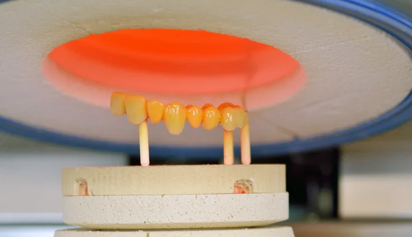 Ceramic compound crowns in furnace — Stock Photo, Image