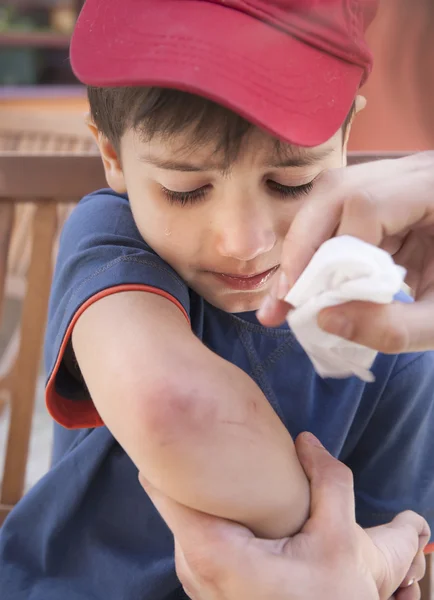 Scraped hand — Stock Photo, Image