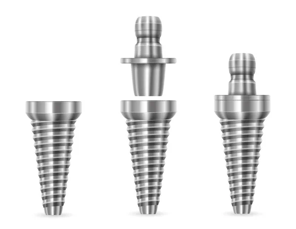 Metal Ludzki Implant Zęba Wektor Ilustracja Izolowane Białym Tle — Wektor stockowy