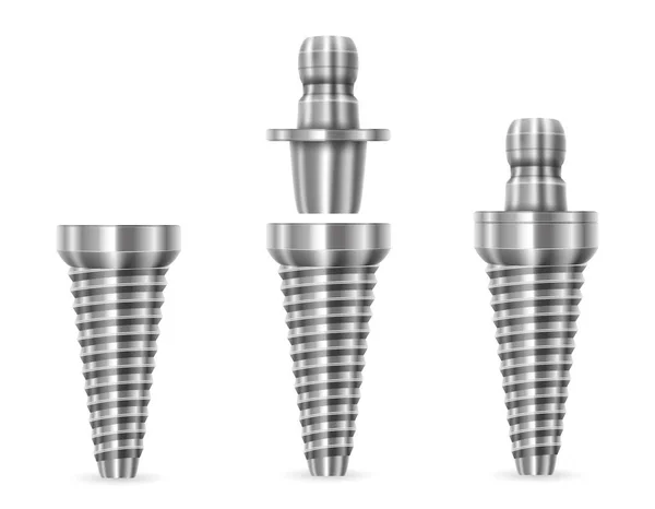 在白色背景下分离的金属人牙植入载体图解 — 图库矢量图片