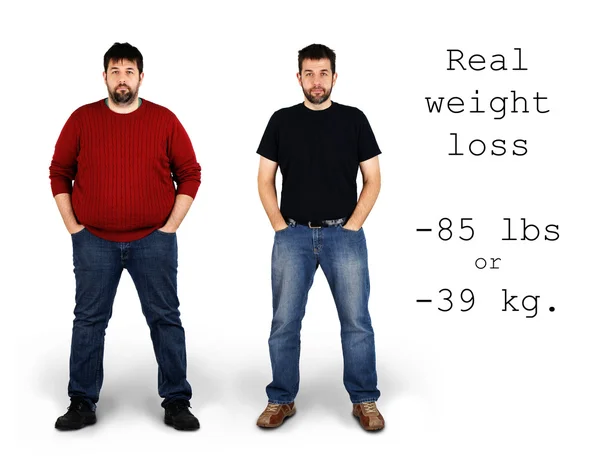 Before and after weight loss — Stock Photo, Image