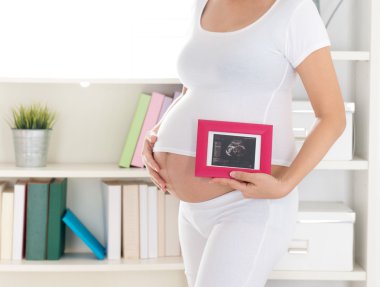Pregnant woman and ultrasound scan photo clipart