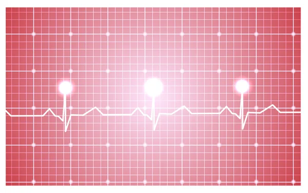 Cuore ed ECG — Vettoriale Stock