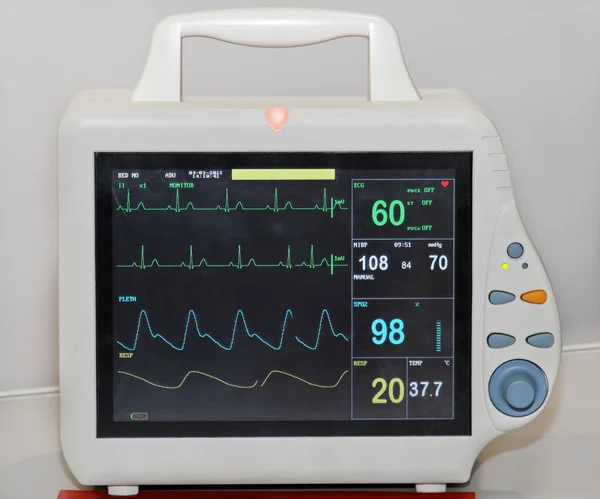 Monitor de frecuencia cardíaca — Foto de Stock
