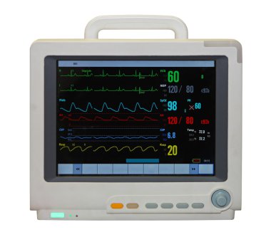 EKG monitör