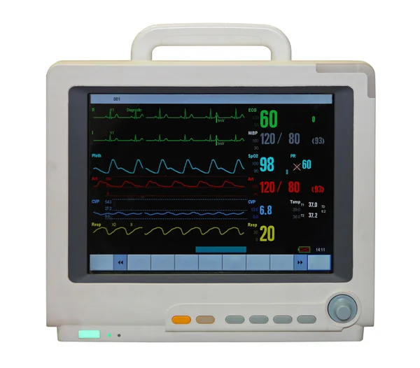 Monitor de ECG — Fotografia de Stock