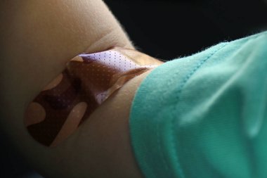 A toddler arm with a bandage after blood testing.