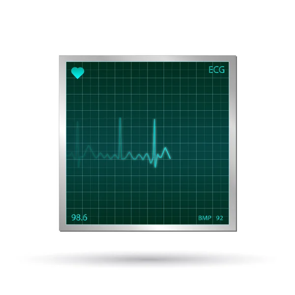 Tıbbi EKG — Stok fotoğraf