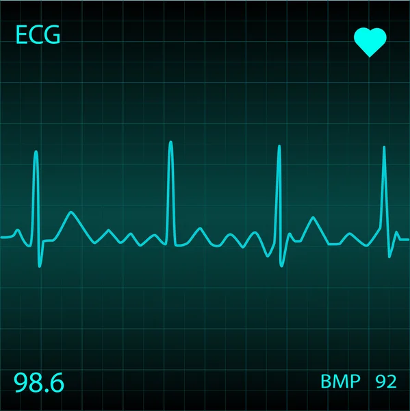 Medical ECG, Illustration — Stock Vector