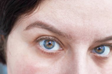 Şaşırmış bir kadın bakışı. Gözlerin yakın görüntüsü. Kadın bir soru soruyor.