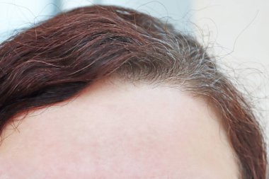 Kadınların yüzünün bir parçası. Kadın alınlı ve kısmen gri saçlı.