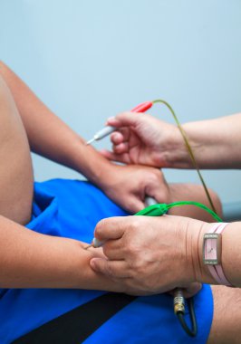 Klinikte akupunktur