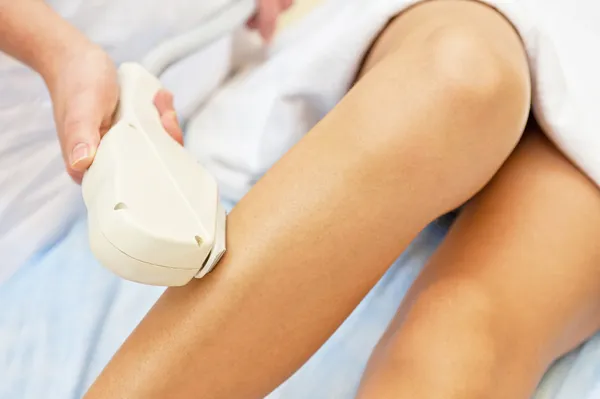 Laser epilation — Stock Photo, Image