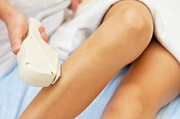 Laser epilation — Stock Photo, Image