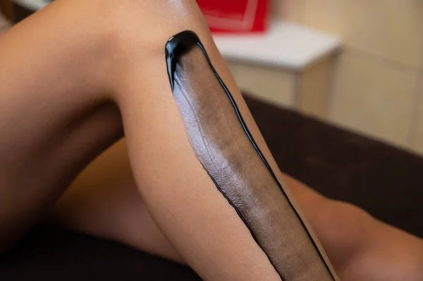 Γυναικεία πόδια closeup σε κλινική ομορφιάς έτοιμο για την αφαίρεση της διαδικασίας των μαλλιών — Φωτογραφία Αρχείου