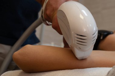 Rf kaldırma işlemi ön kolun iç tarafında.