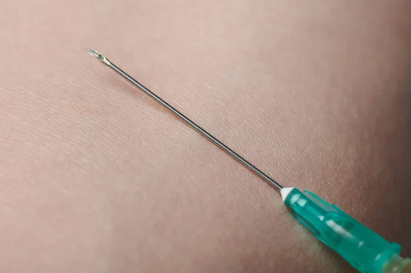 Medicine Syringe Needle Macro Close View Human Skin Background — 图库照片