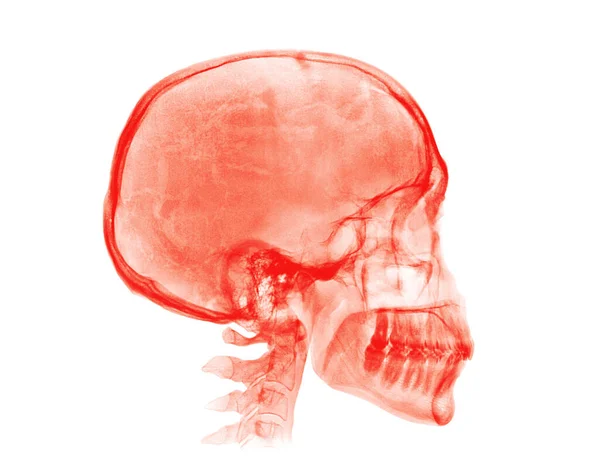 Menselijke Schedel Rood Röntgenbeeld Geïsoleerd Witte Achtergrond — Stockfoto