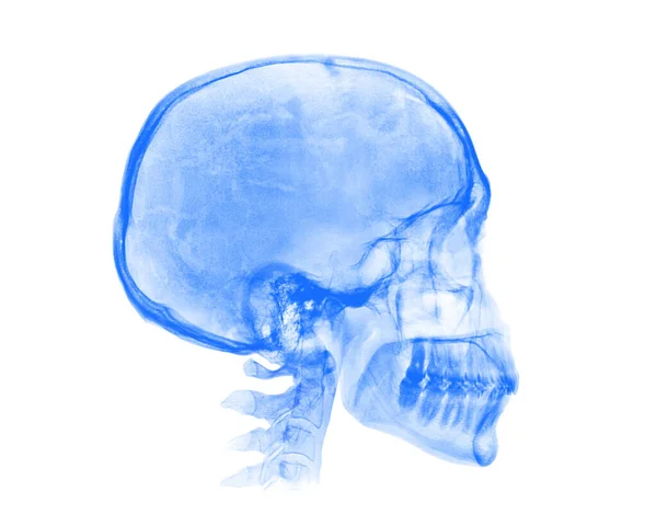 Ludzka Czaszka Niebieski Obraz Rentgenowski Izolowany Białym Tle — Zdjęcie stockowe