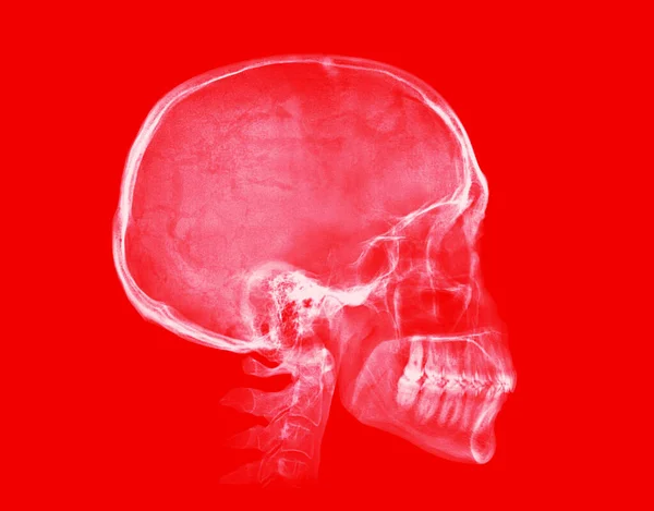 人类的头骨在红色背景上隔离的X射线图像 — 图库照片