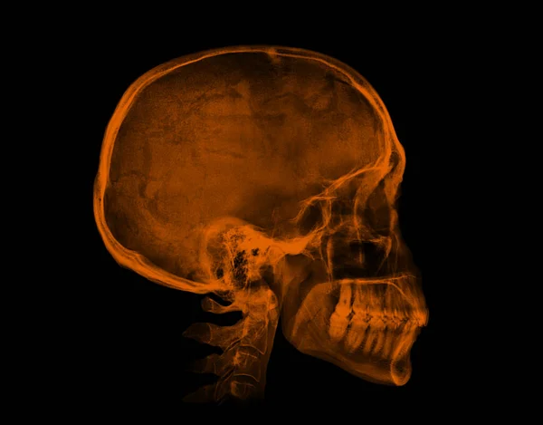 Calavera Humana Imagen Rayos Naranja Aislada Sobre Fondo Negro — Foto de Stock