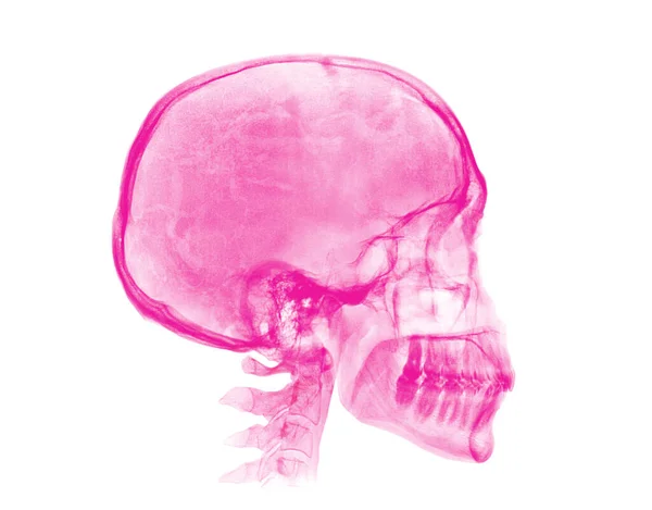 Calavera Humana Imagen Rayos Rosa Aislada Sobre Fondo Blanco — Foto de Stock