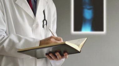 Ortopedi doktoru reçete ve gözlemler bacak x-ray inceledikten sonra yazma