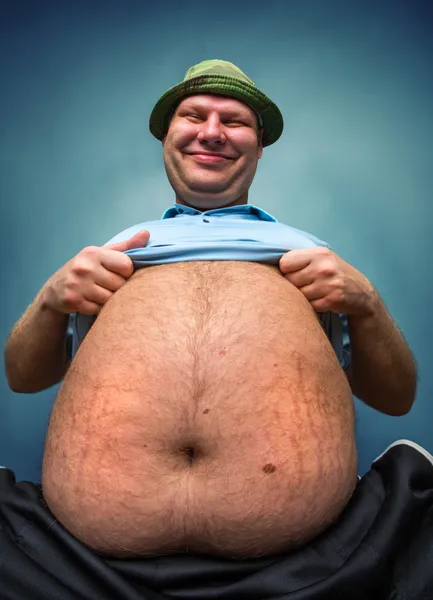 Uomo molto grasso — Foto Stock