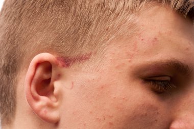 spor sonrası yaralı adam