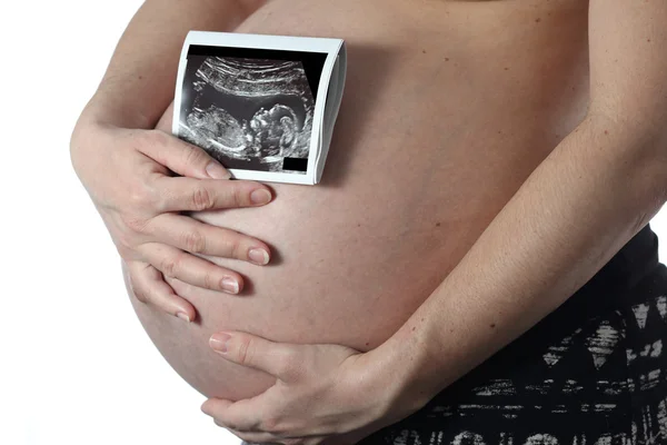 Gravid kvinna — Stockfoto