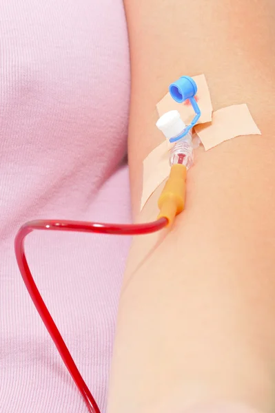 Переливання крові — стокове фото