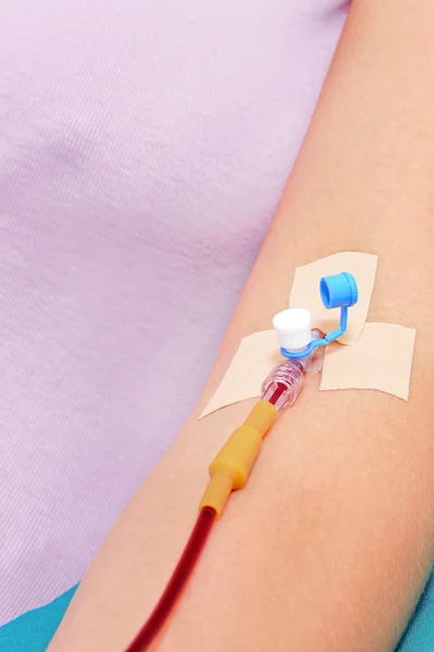 Blood transfusion — Stock Photo, Image