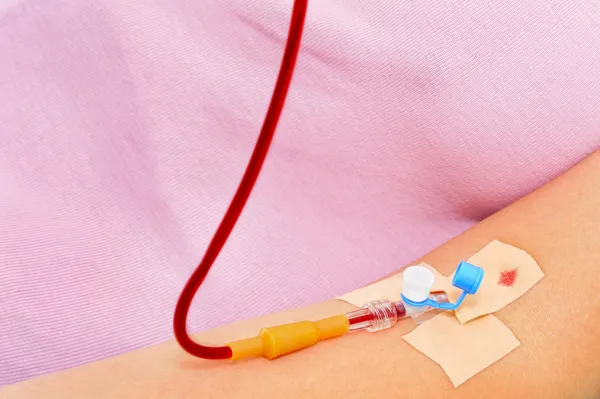 Blood transfusion — Stock Photo, Image