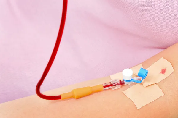 Blood transfusion — Stock Photo, Image