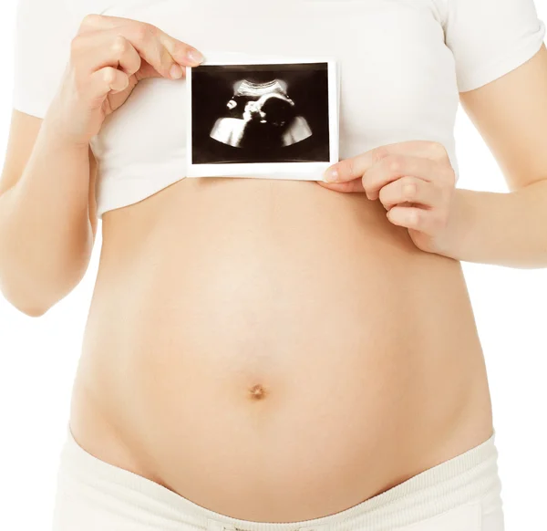 Pregnant woman holding ultrasound scan photo of embryo baby in belly. Prenatal health care concept, white background — Stock Photo, Image