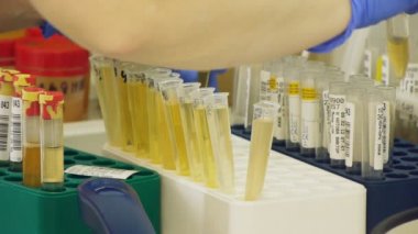 idrar ve kan laboratuvar analizi