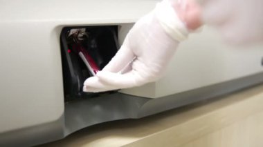 kan örnekleri test