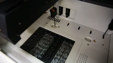 kan örnekleri işleme