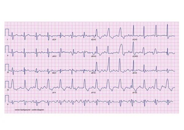 Cardiogram — Stockvector