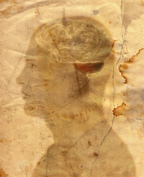 Mann mit Loch im Gehirn — Stockfoto