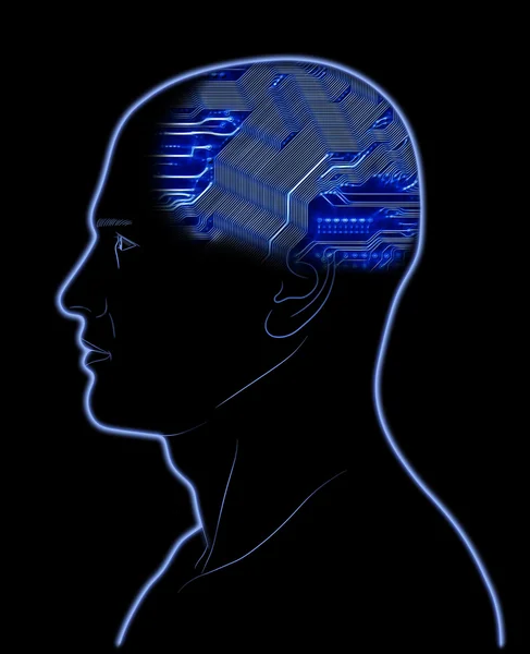 Computer im Kopf — Stockfoto