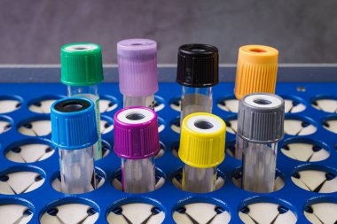 Örnek toplamak için kapaklı plastik test tüpleri. Kan örnekleme tüpleri.