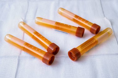 Örnek toplamak için kapaklı plastik test tüpleri. Kan örnekleme tüpleri.