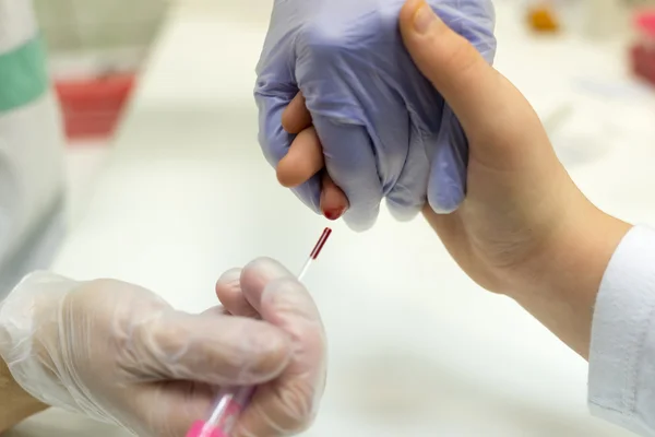 Taking blood from a finger on the analysis — Stock Photo, Image