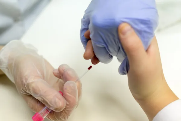 Biorąc krew z palca na podstawie analizy — Zdjęcie stockowe