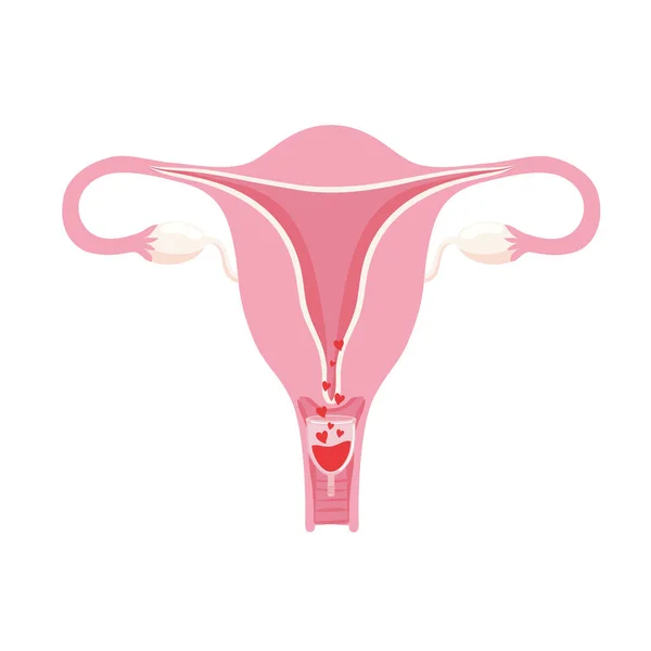 Děloha s menstruačním pohárem — Stockový vektor