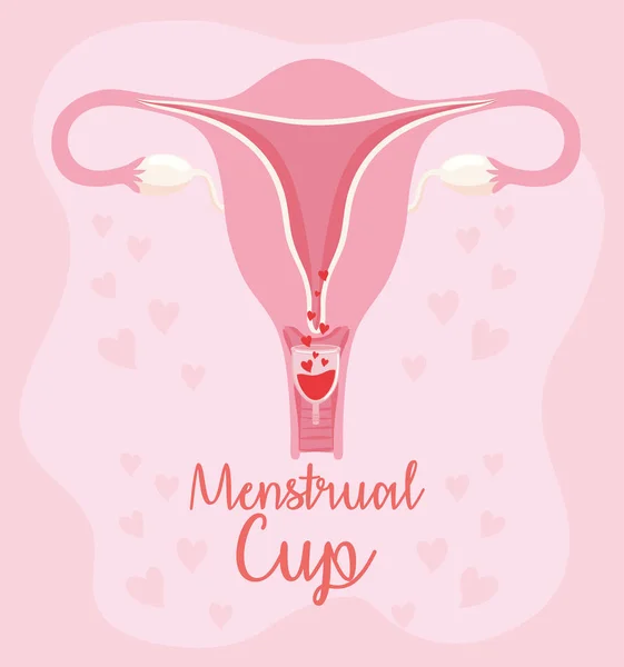 Menstruatiecup in de baarmoeder — Stockvector