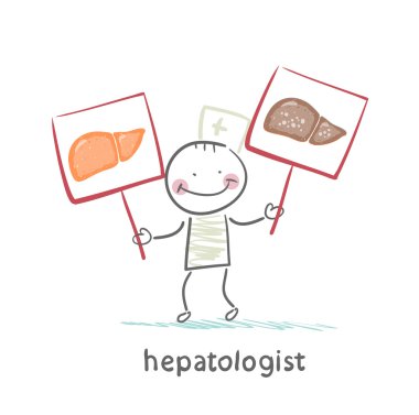 sağlıklı ve hastalıklı karaciğer ile elinde hepatologist