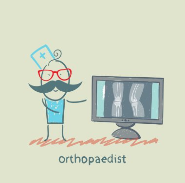 Röntgen orthopaedist LCD ekranda gösterir