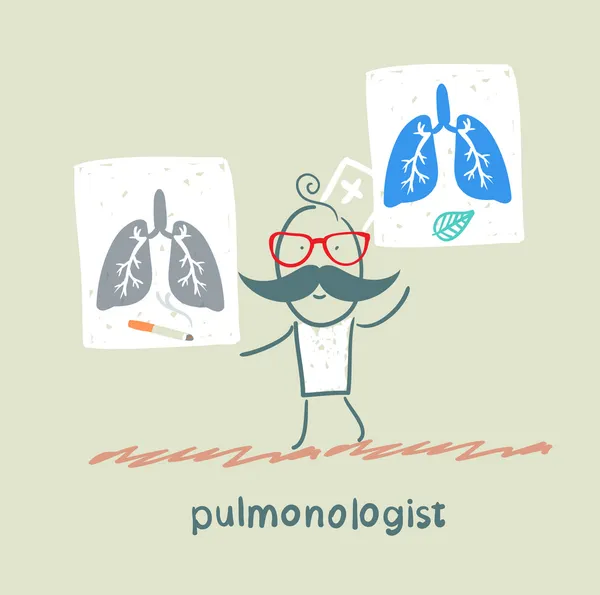 Pulmonologist houden affiches met de afbeelding van de gezonde longen en en longen van de roker — Stockvector